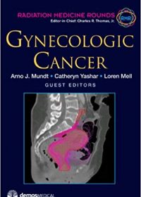 Gynecologic Cancer, 1e (Original Publisher PDF)