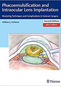 Phacoemulsification and Intraocular Lens Implantation: Mastering Techniques and Complications in Cataract Surgery, 2e (Original Publisher PDF)