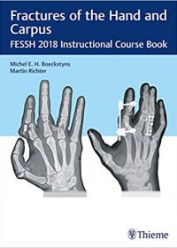 Fractures of the Hand and Carpus: FESSH 2018 Instructional Course Book, 1e (Original Publisher PDF)