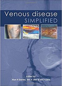 Venous Disease Simplified, 1e (Original Publisher PDF)