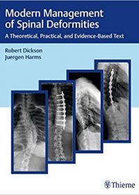 Modern Management of Spinal Deformities: A Theoretical, Practical, and Evidence-based Text, 1e (Original Publisher PDF)