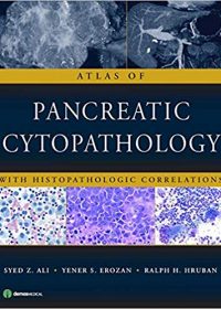 Atlas of Pancreatic Cytopathology: With Histopathologic Correlations, 1e (Original Publisher PDF)