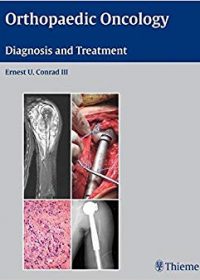 Orthopaedic Oncology: Diagnosis and Treatment, 1e (Original Publisher PDF)