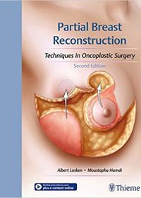 Partial Breast Reconstruction: Techniques in Oncoplastic Surgery, 2e (Original Publisher PDF)