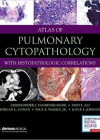 Atlas of Pulmonary Cytopathology, 1e (Original Publisher PDF)