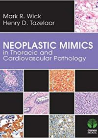 Neoplastic Mimics in Thoracic and Cardiovascular Pathology, 1e (Original Publisher PDF)