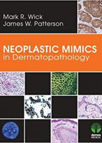 Neoplastic Mimics in Dermatopathology, 1e (Original Publisher PDF)