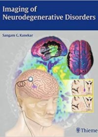 Imaging of Neurodegenerative Disorders, 1e (Original Publisher PDF)