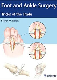 Foot and Ankle Surgery: Tricks of the Trade, 1e (Original Publisher PDF)