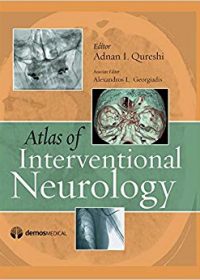 Atlas of Interventional Neurology, 1e (Original Publisher PDF)