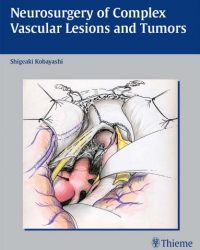 Neurosurgery of Complex Vascular Lesions and Tumors, 1e (Original Publisher PDF)