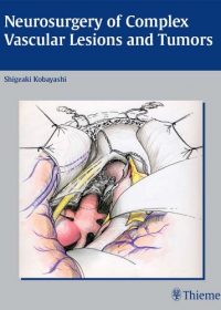 Neurosurgery of Complex Vascular Lesions and Tumors, 1e (Original Publisher PDF)