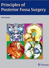 Principles of Posterior Fossa Surgery, 1e (Original Publisher PDF)