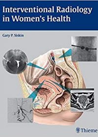 Interventional Radiology in Women's Health, 1e (Original Publisher PDF)