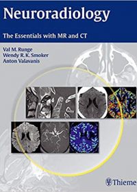 Neuroradiology: The Essentials with MR and CT, 1e (Original Publisher PDF)