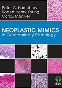 Neoplastic Mimics in Genitourinary Pathology, 1e (Original Publisher PDF)