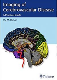 Imaging of Cerebrovascular Disease: A Practical Guide, 1e (Original Publisher PDF)