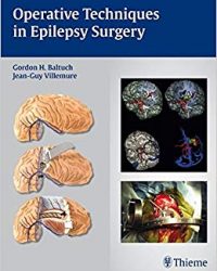 Operative Techniques in Epilepsy Surgery, 1e (Original Publisher PDF)