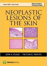 Neoplastic Lesions of the Skin, 1e (Original Publisher PDF)