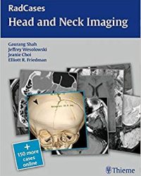 RadCases Head and Neck Imaging, 1e (Original Publisher PDF)