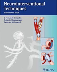 Neurointerventional Techniques: Tricks of the Trade, 1e (Original Publisher PDF)