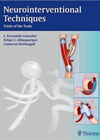 Neurointerventional Techniques: Tricks of the Trade, 1e (Original Publisher PDF)