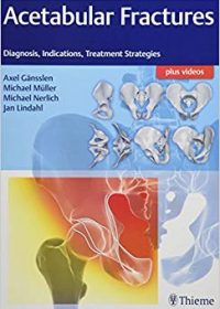 Acetabular Fractures: Diagnosis, Indications, Treatment Strategies, 1e (Original Publisher PDF)