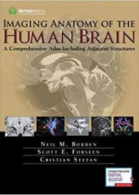 Imaging Anatomy of the Human Brain: A Comprehensive Atlas Including Adjacent Structures, 1e (Original Publisher PDF)