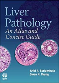Liver Pathology: An Atlas and Concise Guide, 1e (Original Publisher PDF)