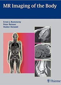 MR Imaging of the Body, 1e (Original Publisher PDF)