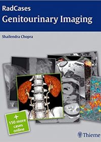 Radcases Genitourinary Imaging, 1e (Original Publisher PDF)