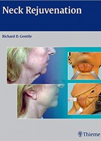 Neck Rejuvenation, 1e (Original Publisher PDF)