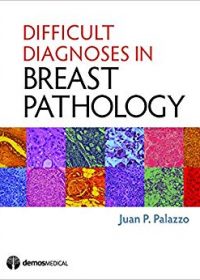 Difficult Diagnoses in Breast Pathology, 1e (Original Publisher PDF)