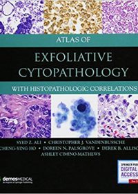 Atlas of Exfoliative Cytopathology: With Histopathologic Correlations, 1e (Original Publisher PDF)