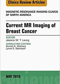 Current MR Imaging of Breast Cancer, An Issue of Magnetic Resonance Imaging Clinics of North America, 1e (Original Publisher PDF)