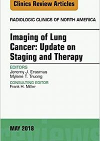 Lung Cancer, An Issue of Radiologic Clinics of North America, 1e (Original Publisher PDF)