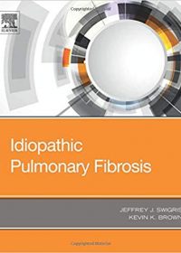 Idiopathic Pulmonary Fibrosis, 1e (Original Publisher PDF)
