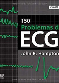 150 problemas de ECG, 4e (Original Publisher PDF)