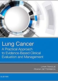 Lung Cancer: A Practical Approach to Evidence-Based Clinical Evaluation and Management, 1e (Original Publisher PDF)