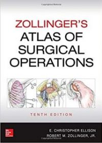 Zollinger's Atlas of Surgical Operations, 10e (EPUB)