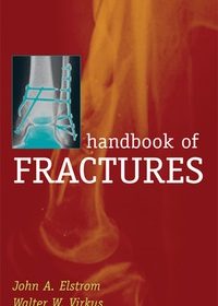 Handbook of Fractures, 3e (Original Publisher PDF)