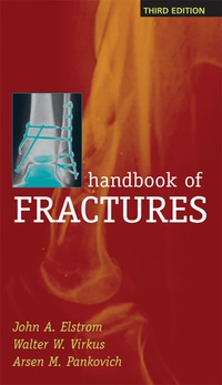 Handbook of Fractures, 3e (Original Publisher PDF)