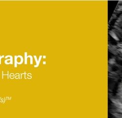 Fetal Echocardiography: Normal and Abnormal Hearts 2019 (Videos+PDFs)