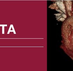 Classic Lectures in Cardiac CTA 2018 (Videos)