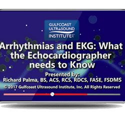 Arrhythmias and EKG: What the Echocardiographer Needs to Know (Videos)