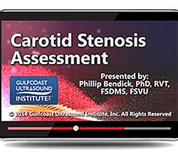 Carotid Stenosis Assessment (Videos+PDFs)