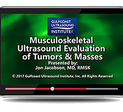 MSK Ultrasound Evaluation of Tumors and Masses (Videos+PDFs)