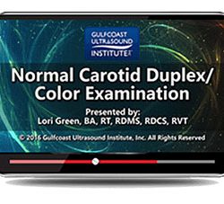 Normal Carotid Duplex/Color Examination (Videos+PDFs)