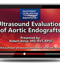 Ultrasound Evaluation of Aortic Endografts (Videos+PDFs)