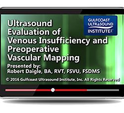 Ultrasound Evaluation of Venous Insufficiency and Preoperative Vascular Mapping (Videos+PDFs)